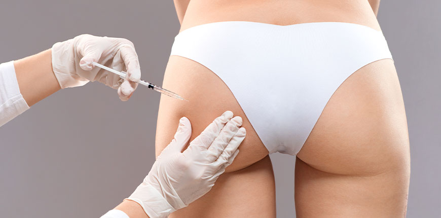 Lifting Brésilien des Fesses (LBF)